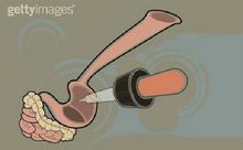 肠原性青紫病 肠原性青紫病