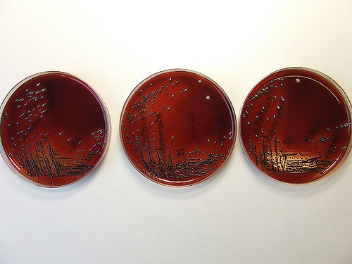 中间普雷沃菌 网络释义专业释义英英释义                   中间